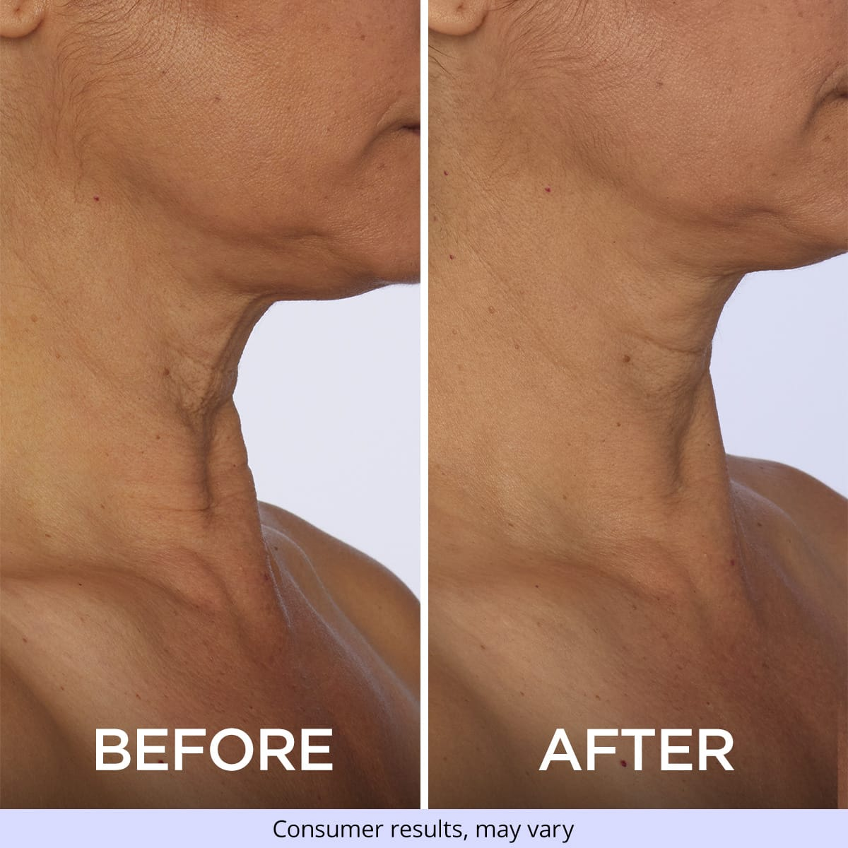 Tighten & Lift Neck Cream-specially formulated to target and combat sagging skin on the neck and chest, providing a visibly firmer and more lifted appearance.