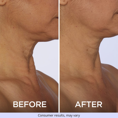 Tighten & Lift Neck Cream-specially formulated to target and combat sagging skin on the neck and chest, providing a visibly firmer and more lifted appearance.