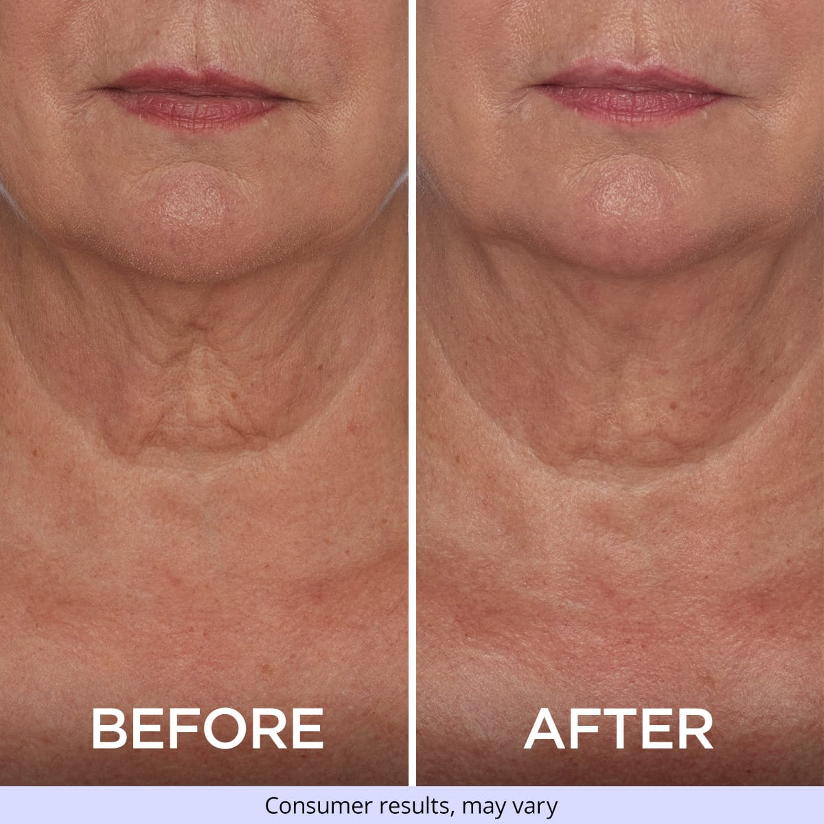 Tighten & Lift Neck Cream-specially formulated to target and combat sagging skin on the neck and chest, providing a visibly firmer and more lifted appearance.