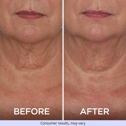 Tighten & Lift Neck Cream-specially formulated to target and combat sagging skin on the neck and chest, providing a visibly firmer and more lifted appearance.